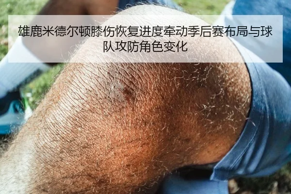 雄鹿米德尔顿膝伤恢复进度牵动季后赛布局与球队攻防角色变化 - kaiyun